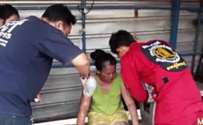 เผากระป๋องสีสเปรย์ระเบิดไฟลุกไหม้ตัวบาดเจ็บ