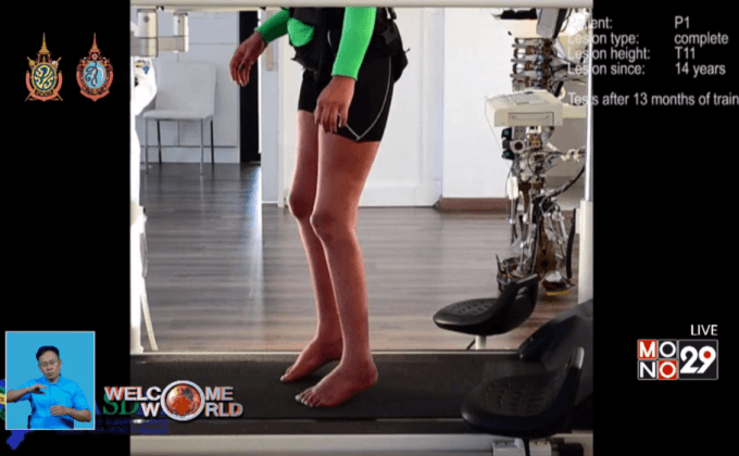 อุปกรณ์ฟื้นฟูผู้ป่วยอัมพาต