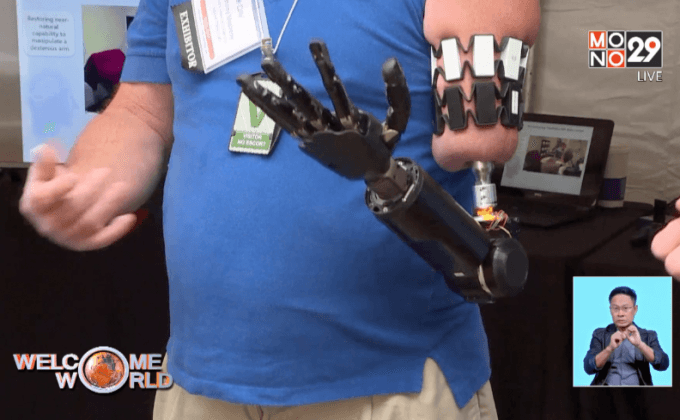 อวัยวะเทียมของ DARPA