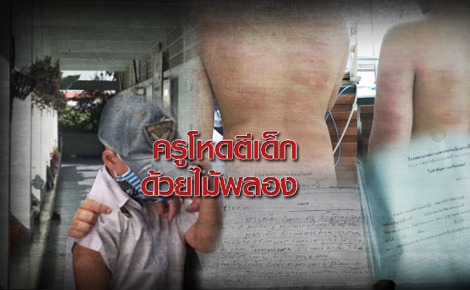 ครูโหดตีเด็กด้วยไม้พลอง
