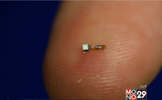 เซ็นเซอร์ตรวจระบบประสาทจิ๋ว