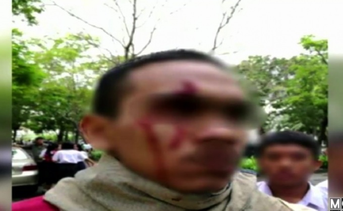 นักเรียน ม.6ถูกคู่อริต่างสถาบันใช้ขวานไล่ฟันบาดเจ็บ