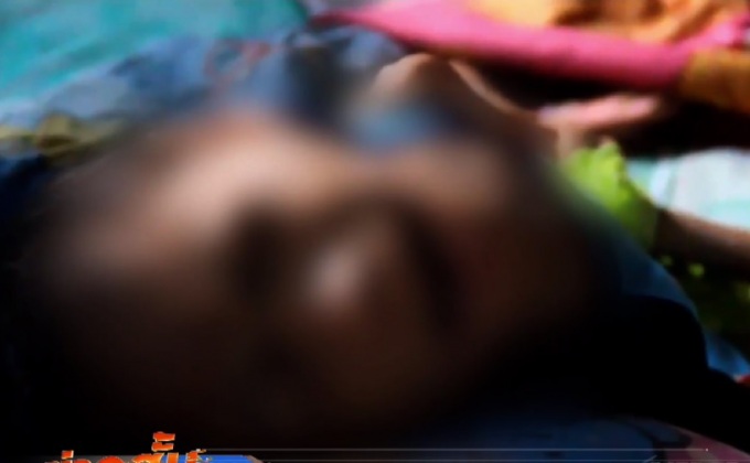 วอนช่วยเหลือเด็กหญิงวัย 12 ปี ป่วยโรคสมองฝ่อ