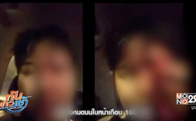 ออกหมายจับดีเจสาวหล่อ ใช้แก้วทุบหน้าสาวเย็บ 100 เข็ม