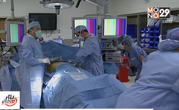 งานวิจัยชี้ การผ่าตัดรักษาโรคอ้วนลดความเสี่ยงโรคหัวใจ