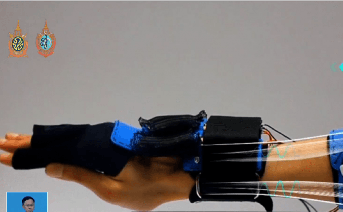 อุปกรณ์ช่วยการเคลื่อนไหว