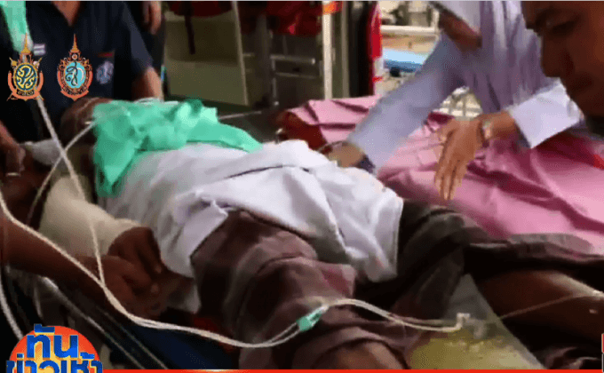 ทหารพรานประกอบระเบิดพลาด ตูมสนั่น! มือขาด