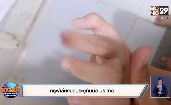 ครูพี่เลี้ยงปิดประตูทับนิ้ว นร.ขาด