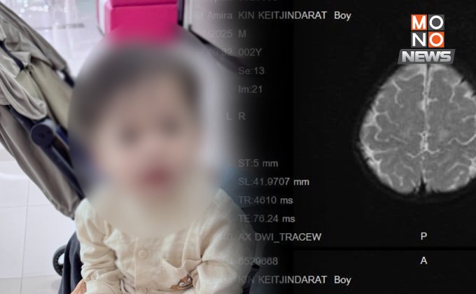 แห่ส่งกำลังใจ! แม่โพสต์ลูกวัย 2 ขวบ ป่วยโรคหายาก – ค่ารักษา 140 ล้าน