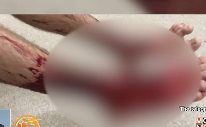 วัยรุ่นออสเตรเลียถูกสัตว์ลึกลับกัดเป็นแผลฉกรรจ์