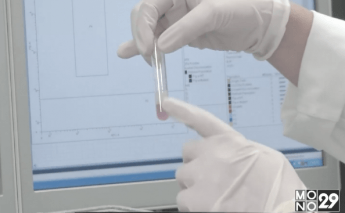 ตรวจเลือดหาเซลล์ผิดปกติที่อาจนำไปสู่โรคมะเร็ง