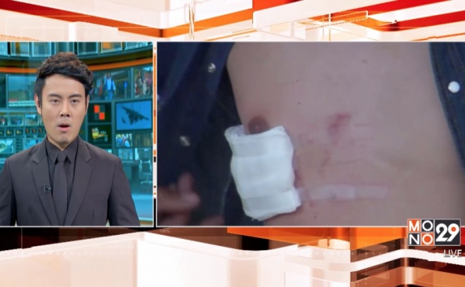 ร้องคดี ตร.สกลนคร ทำร้ายร่างกายไม่คืบหน้า