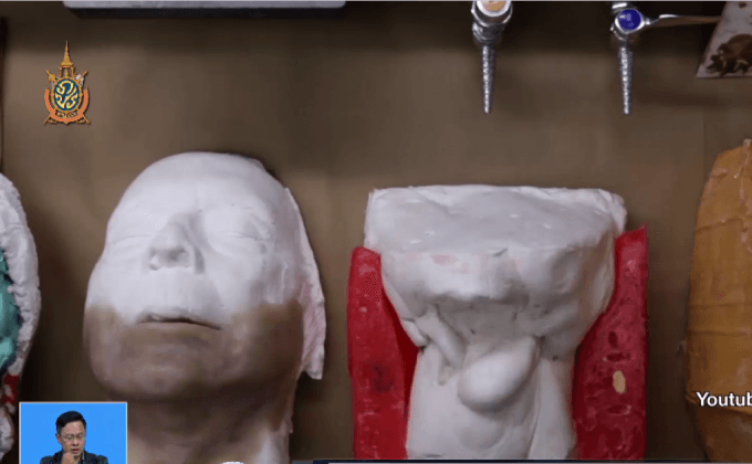 อวัยวะเทียมจากเครื่องพิมพ์ 3 มิติ