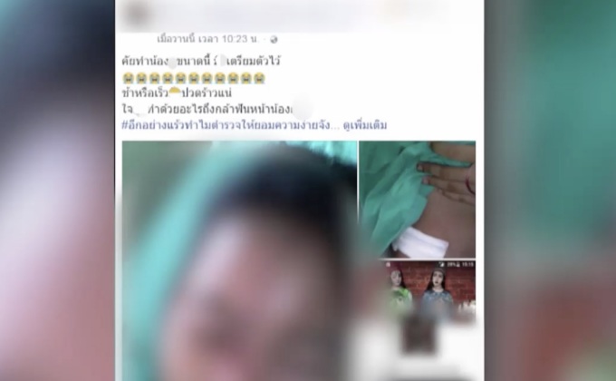 เด็กสาว 16 ปี ถูกฟันหน้าปมทะเลาะในเฟซบุ๊ก