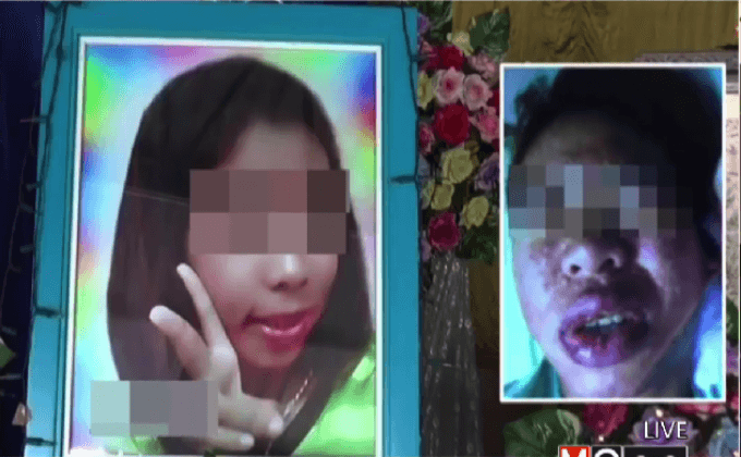 แพ้สารสกัดหมามุ่ยอินเดียเสียชีวิต